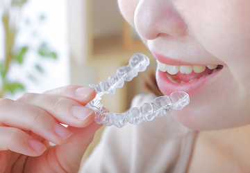 マウスピース矯正