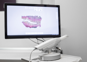 口腔内スキャナーによる精密な診断